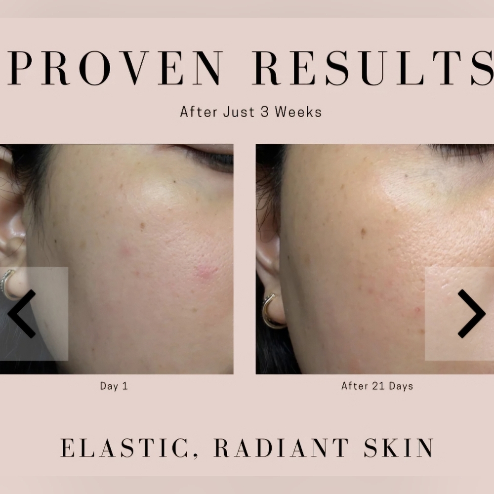 SAINT JANE Rich Rescue Phyto-Mucin Cream Vegan Snail W Niacinamide 1.7oz NEW - Picture 4 of 16